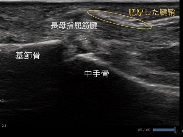 如何科学运用花呗